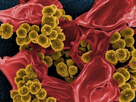 Искусственные подсластители помогают распространению устойчивости к антибиотикам у бактерий