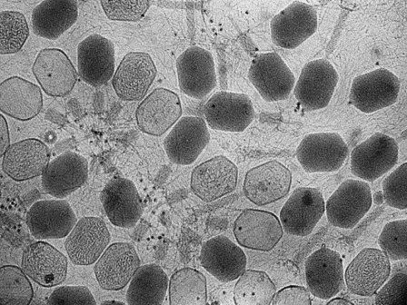 На бактериях из кишечника человека паразитируют более 140 тысяч видов бактериофагов
